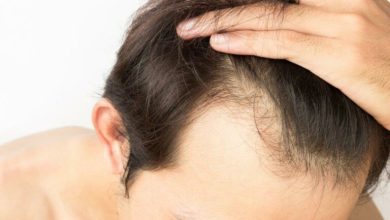 Hair Transplant in Ludhiana with optimum results