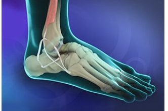 Where to Get the Best Ligament Surgery Ankle in Scottsdale