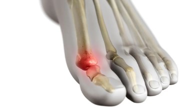 Why Consult a Specialist for MTP Joint Pain