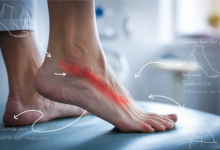 How Can You Prevent Outside of Foot Pain from Disrupting Your Daily Life?